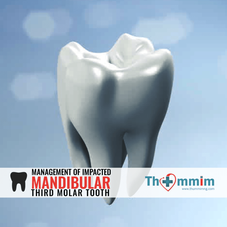 Impacted Mandibular Third Molar Surgery – An overview